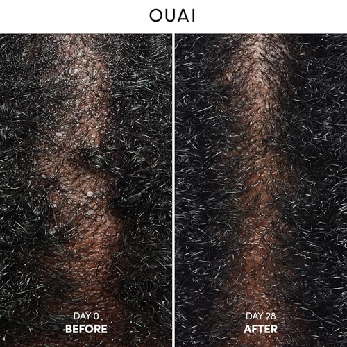 OUAI Anti Dandruff Shampoo - Soothing Salicylic Acid for Flaky Scalp - Reduces Itching and Redness (10 Fl Oz)  
OUAI Ant